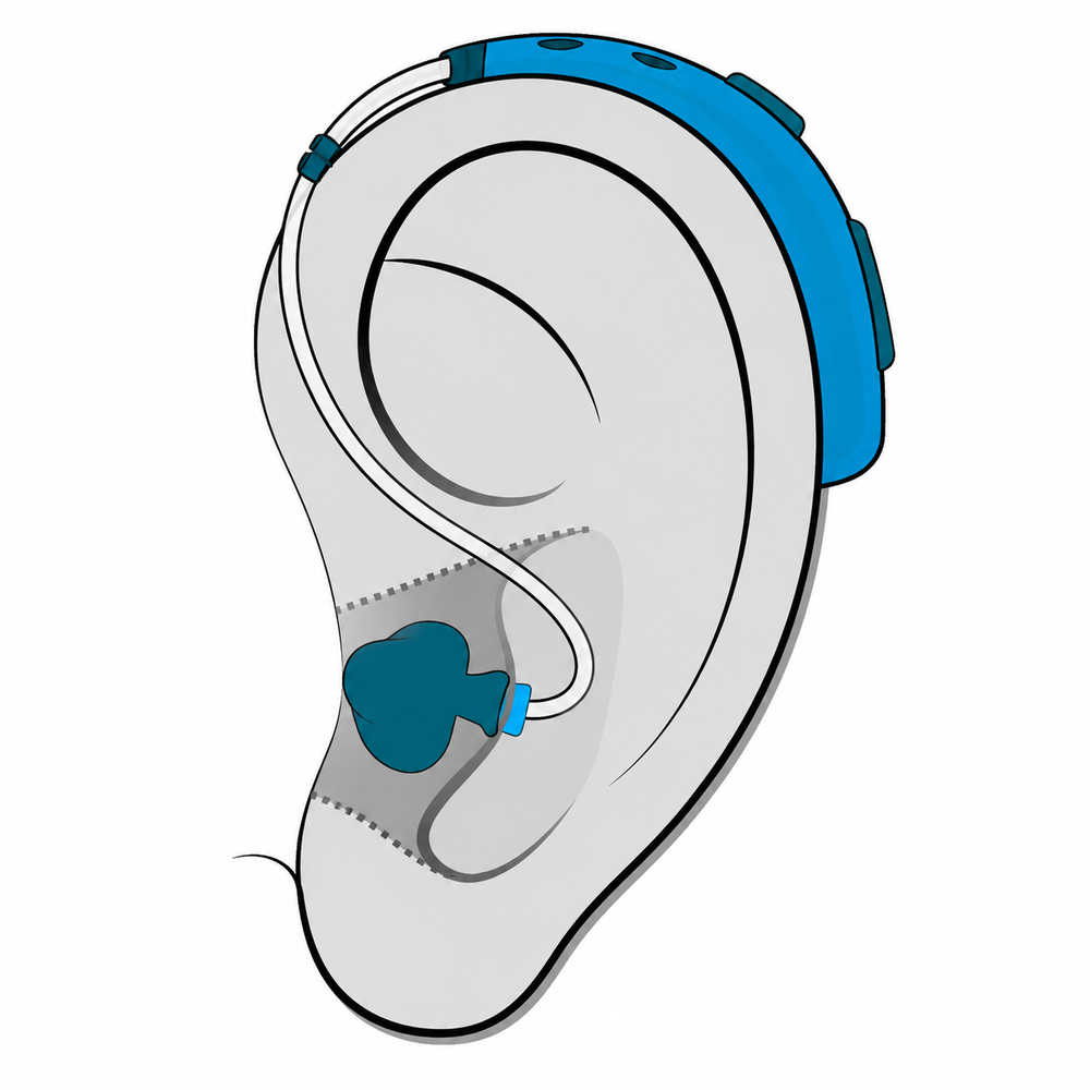 Behind-the-Ear (BTE) hearing aid style