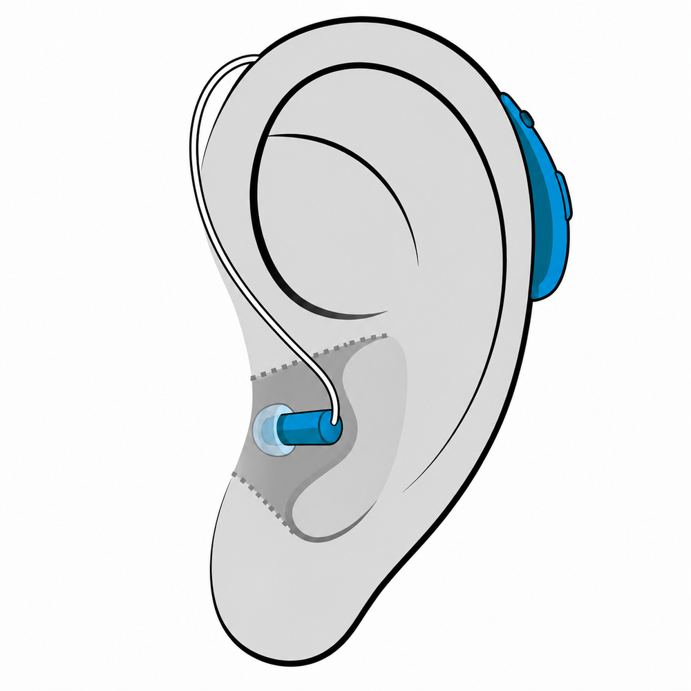 Receiver-in-Canal (RIC) hearing aid style